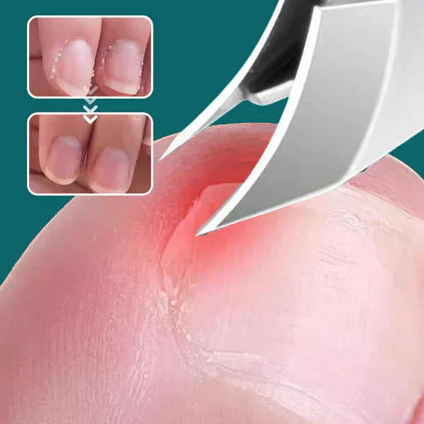 Anti-slask snedkant nagelklippare 3-stycke uppsättning